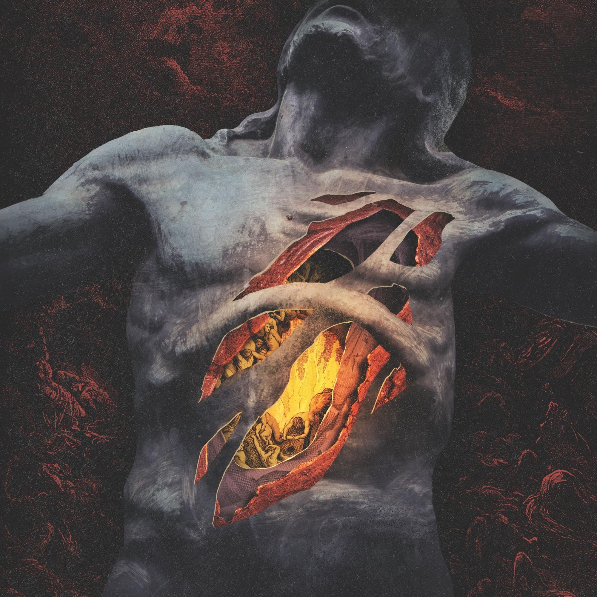 ibs