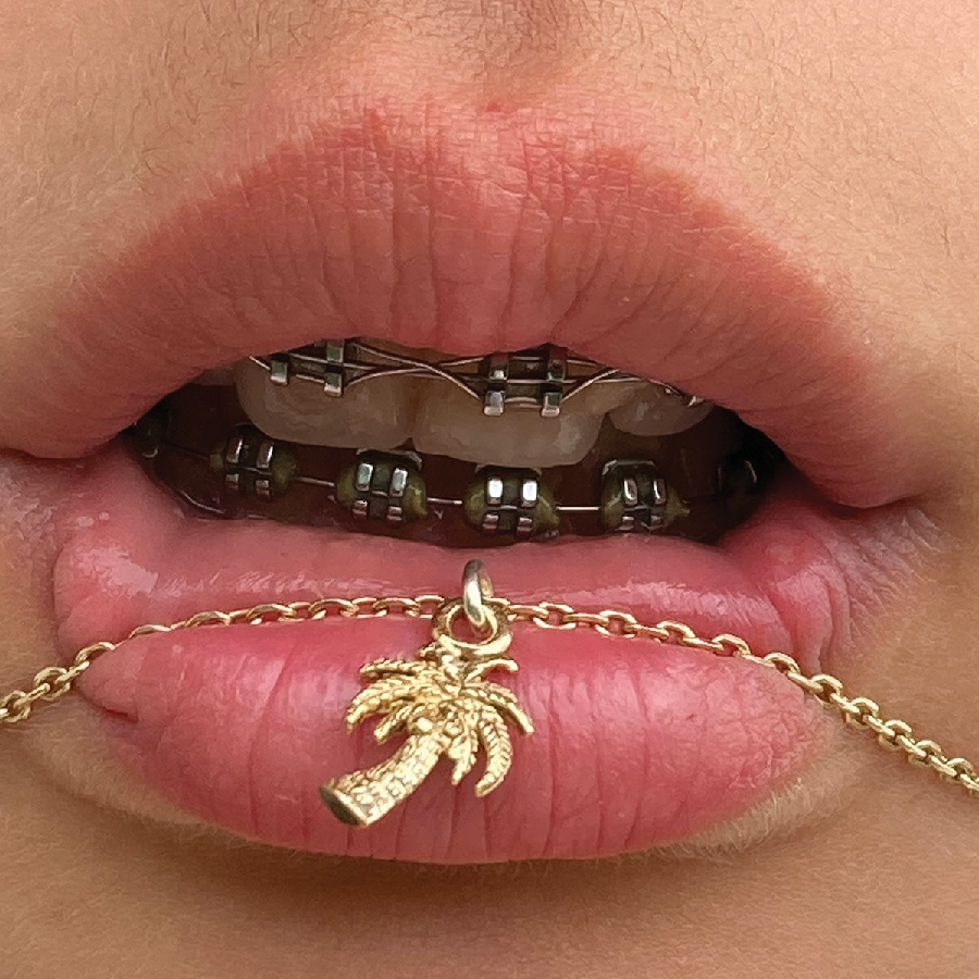 ibs