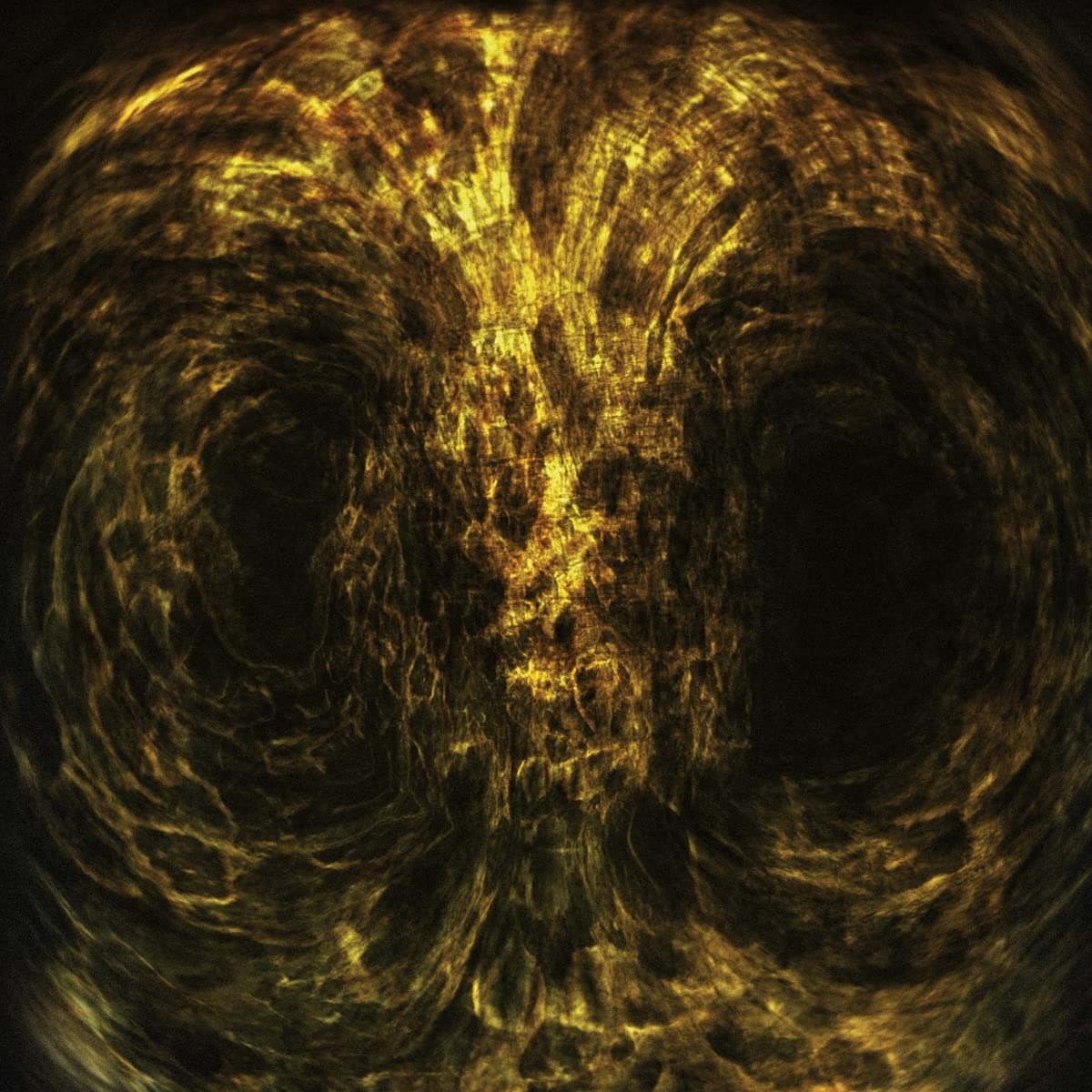 ibs