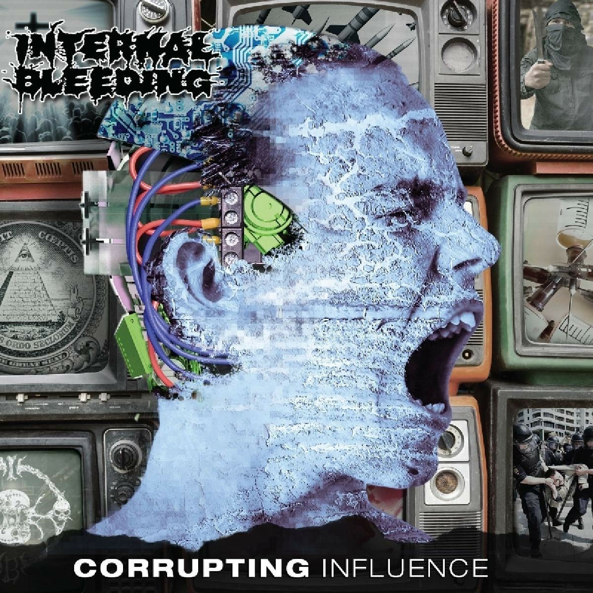 ibs