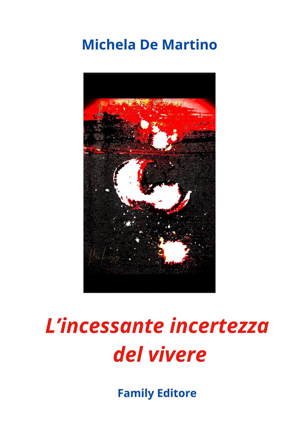 ibs