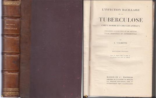 L' Infection Tuberculose - copertina
