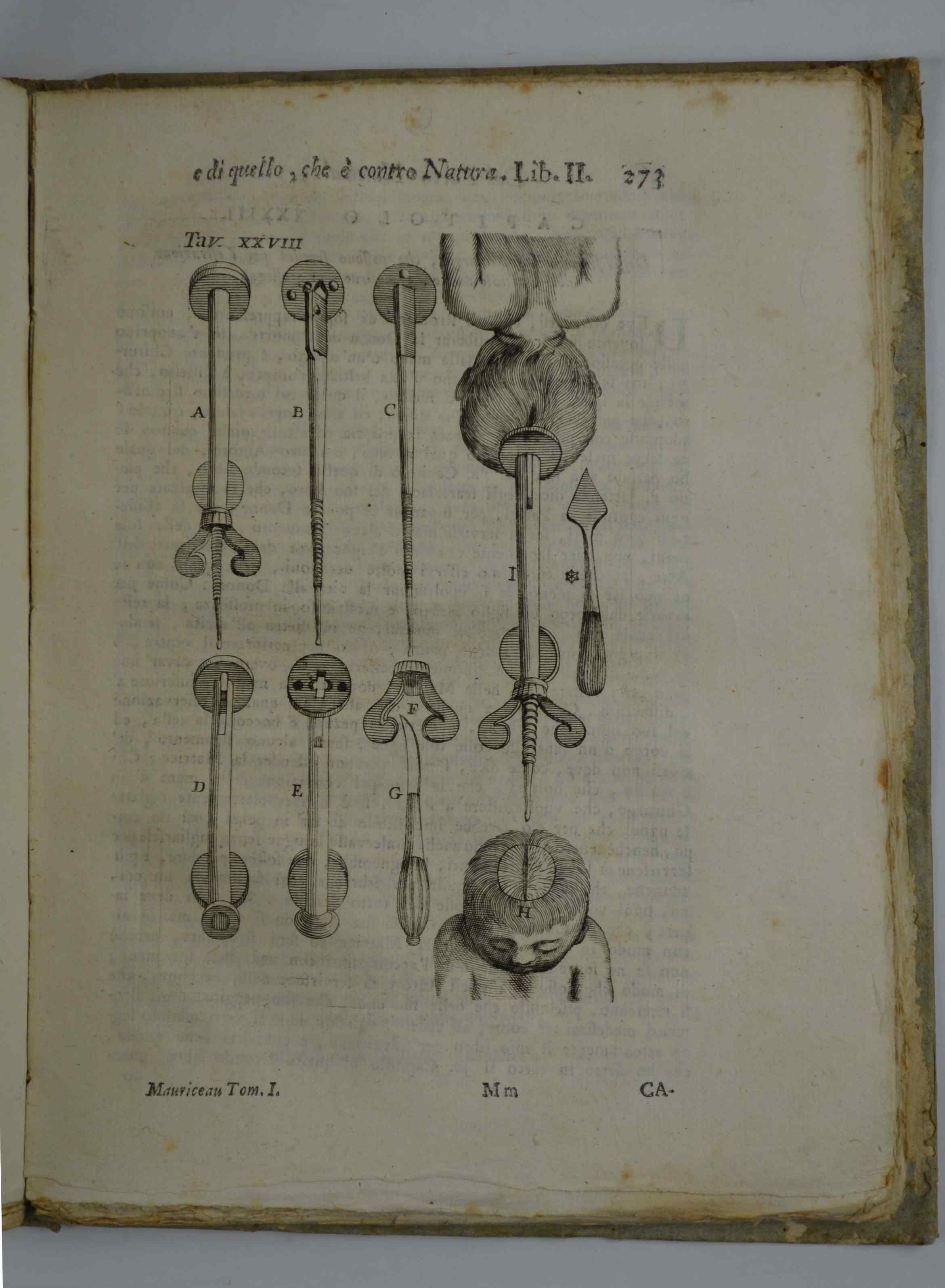 Opere medico-chirurgiche Traduzione dal francese giusta l'ultima edizione riveduta, corretta ed accresciuta dall'Autore.