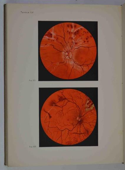 Fundus oculi. Diagnostica oftalmoscopica - copertina