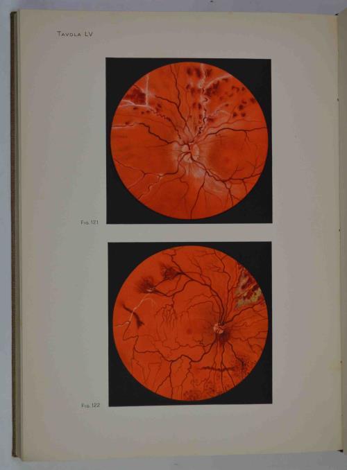 Fundus oculi. Diagnostica oftalmoscopica - copertina