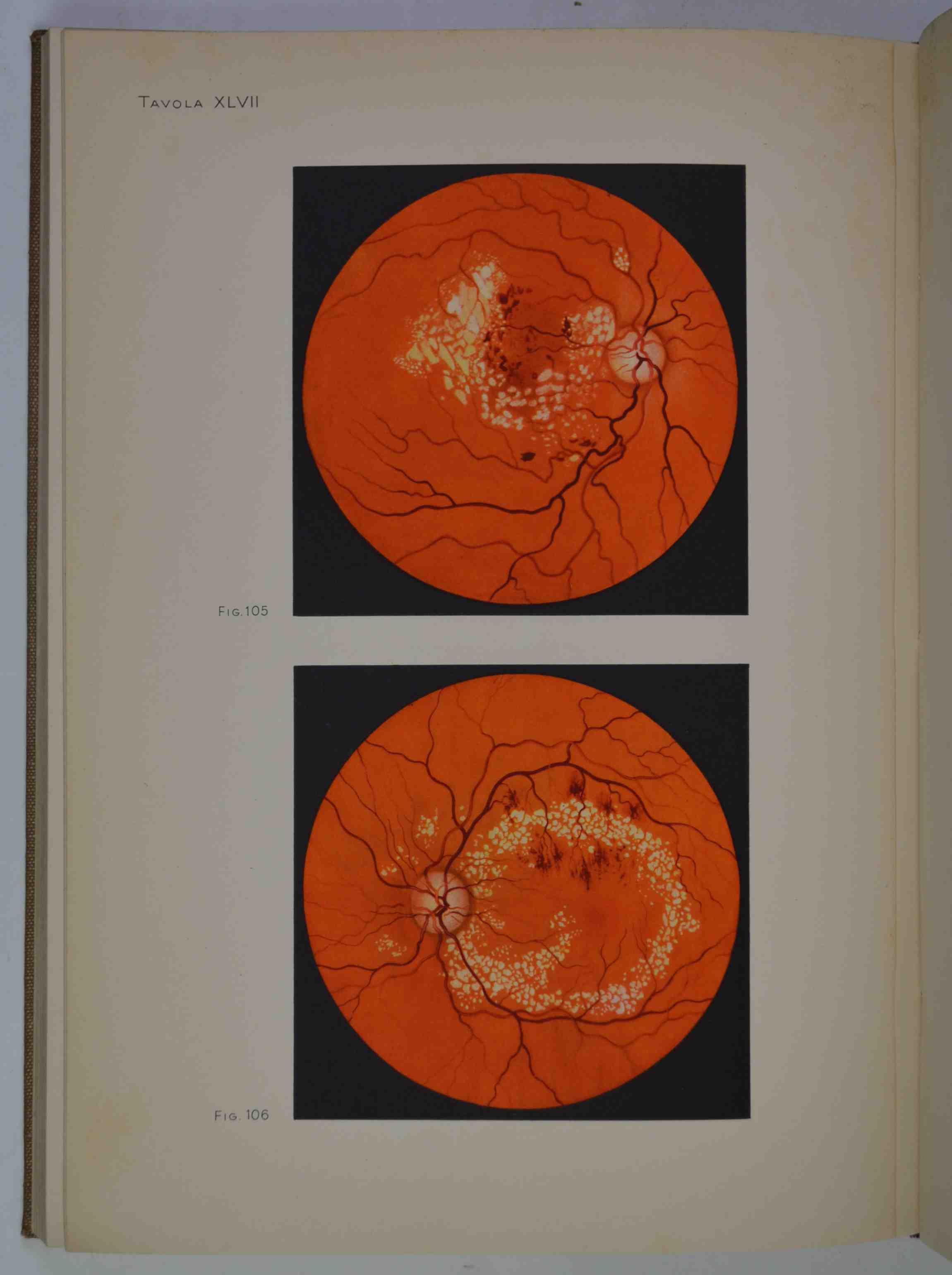 Fundus oculi. Diagnostica oftalmoscopica