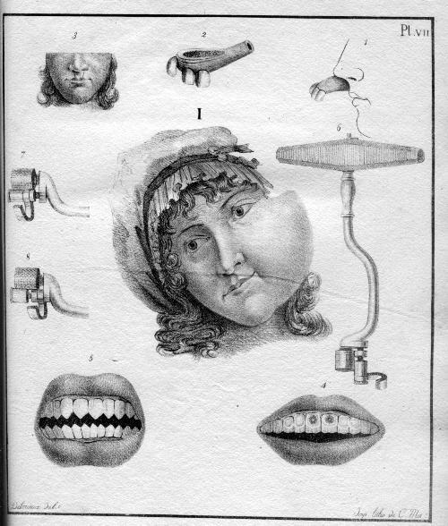 Histoire naturelle de maladies des dents de l'espèce humaine. Ouvrage traduit de l'anglais par le Chevalier Lemaire - Joseph Fox - copertina