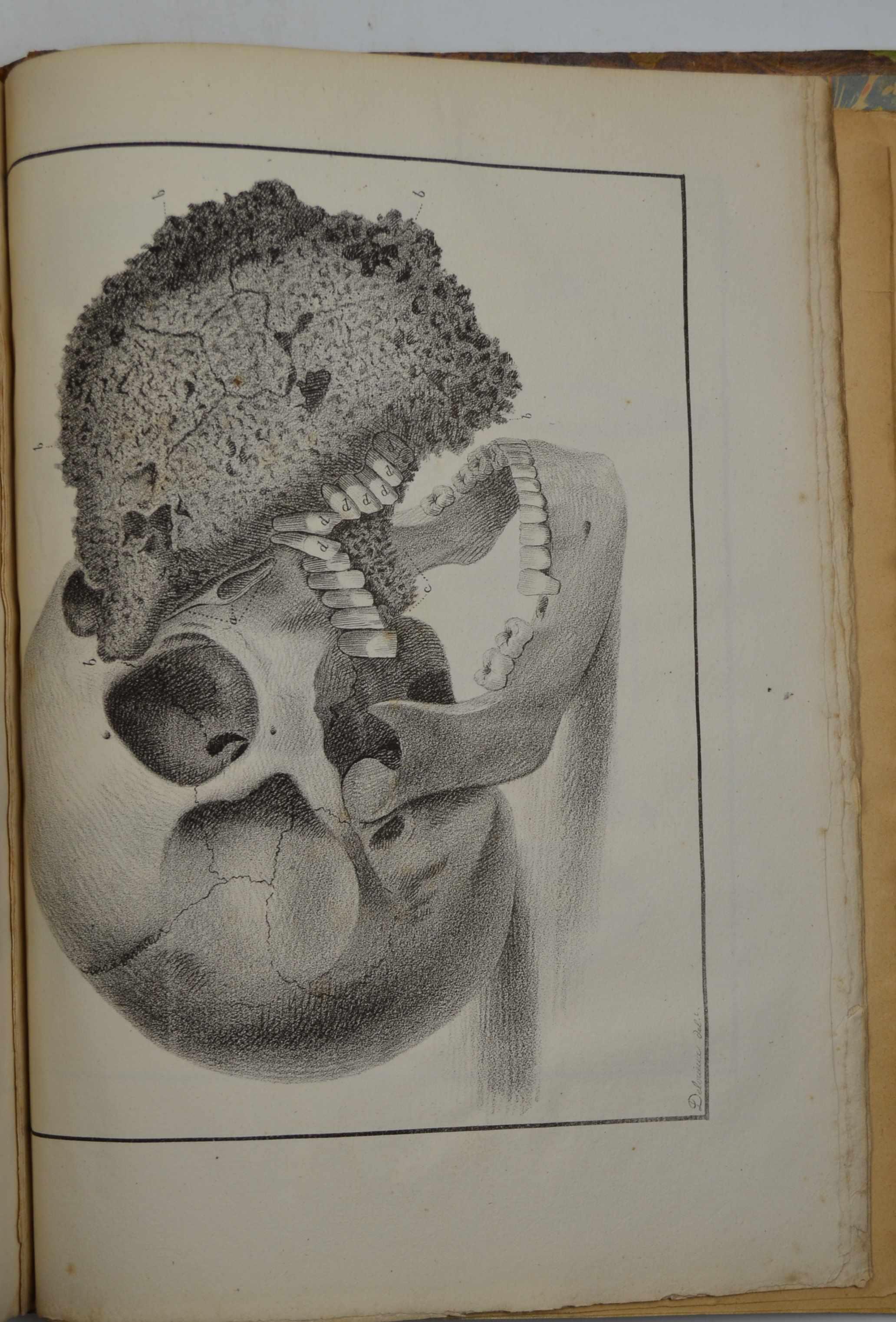 Histoire naturelle de maladies des dents de l'espèce humaine. Ouvrage traduit de l'anglais par le Chevalier Lemaire