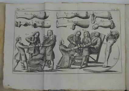 Institutiones chirurgicae in quibus quidquid ad rem chirurgicam pertinet, optima et novissima ratione pertractatur. - Lorenz Heister - copertina