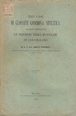 Tre casi di glossite gommosa sifilitica guariti mediante le injezioni intra-muscolari di calomelano