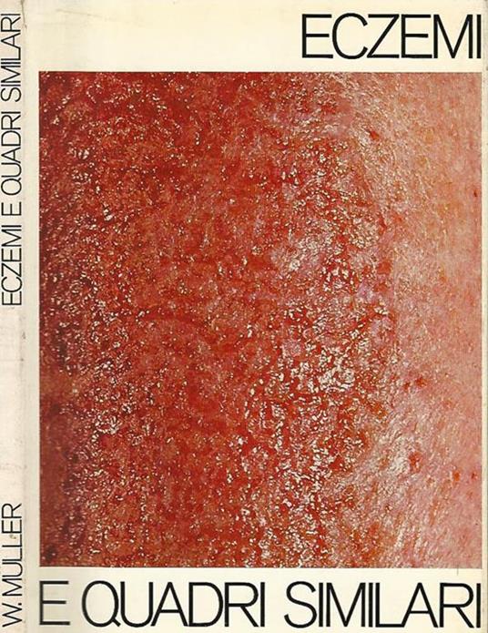 Eczemi e quadri similari - Werner Muller - copertina