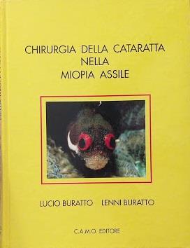 Chirurgia della cataratta nella miopia assile - Lucio Buratto - copertina
