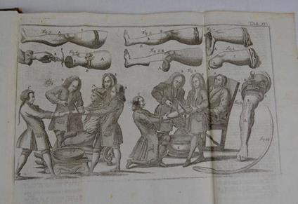 Opere… - Lorenz Heister - copertina