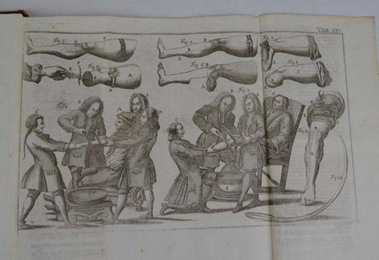 Opere… - Lorenz Heister - copertina