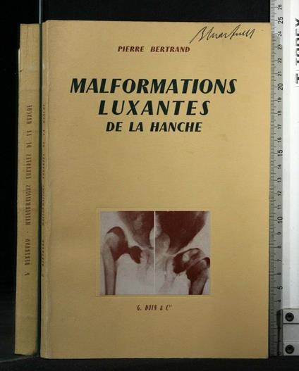 Malformations Luxantes De La Hanche - Pierre Bertrand - copertina