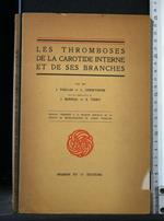 Les Thromboses De La Carotide Interne Et De Ses Branches