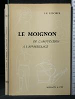 Le Moignon De L'Amputation a L'Appareillage