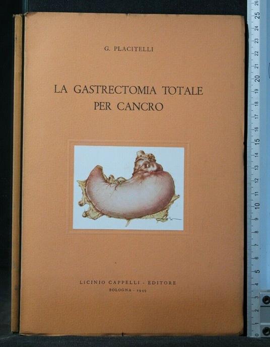 La Gastrectomia Totale per Cancro - Gastrectomia Totale per Cancro di: Placitelli - copertina