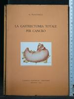 La Gastrectomia Totale per Cancro