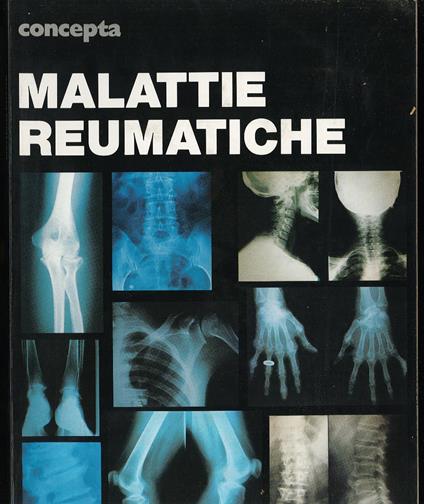 Malattie Reumatiche - copertina