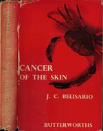Cancer of the skin