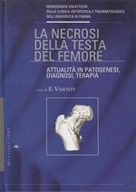 La Necrosi Della Testa Del Femore