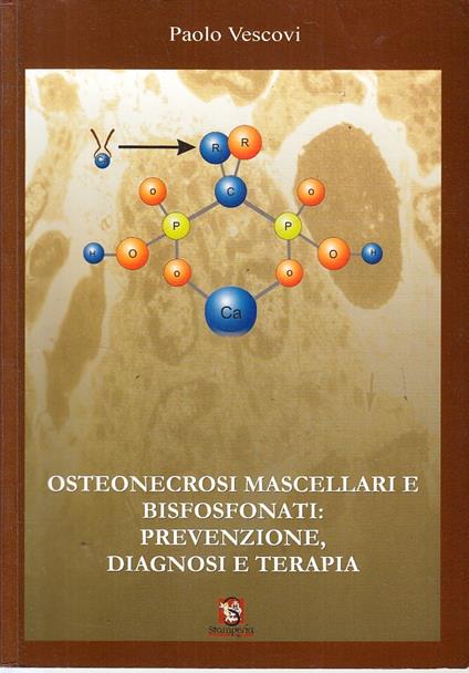Osteonecrosi Mascellari E Bisfosfonati - copertina