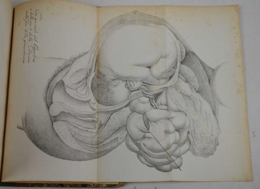 Elementi di patologia generale… Tradotti ed annotati… dal professore Luigi Calori - copertina