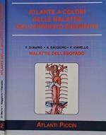 Malattie dell'esofago