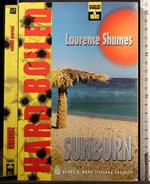 Sunburn
