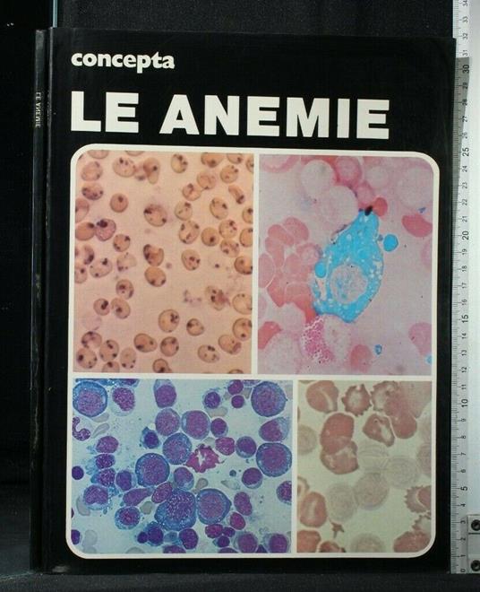 Concepta Le Anemie - copertina