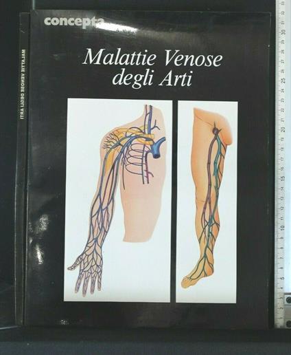 Malattie Venose Degli Arti - copertina