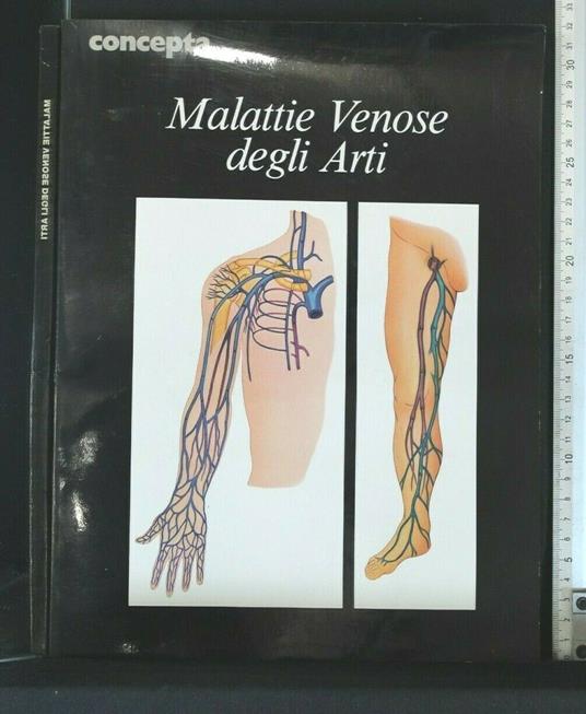 Malattie Venose Degli Arti - copertina
