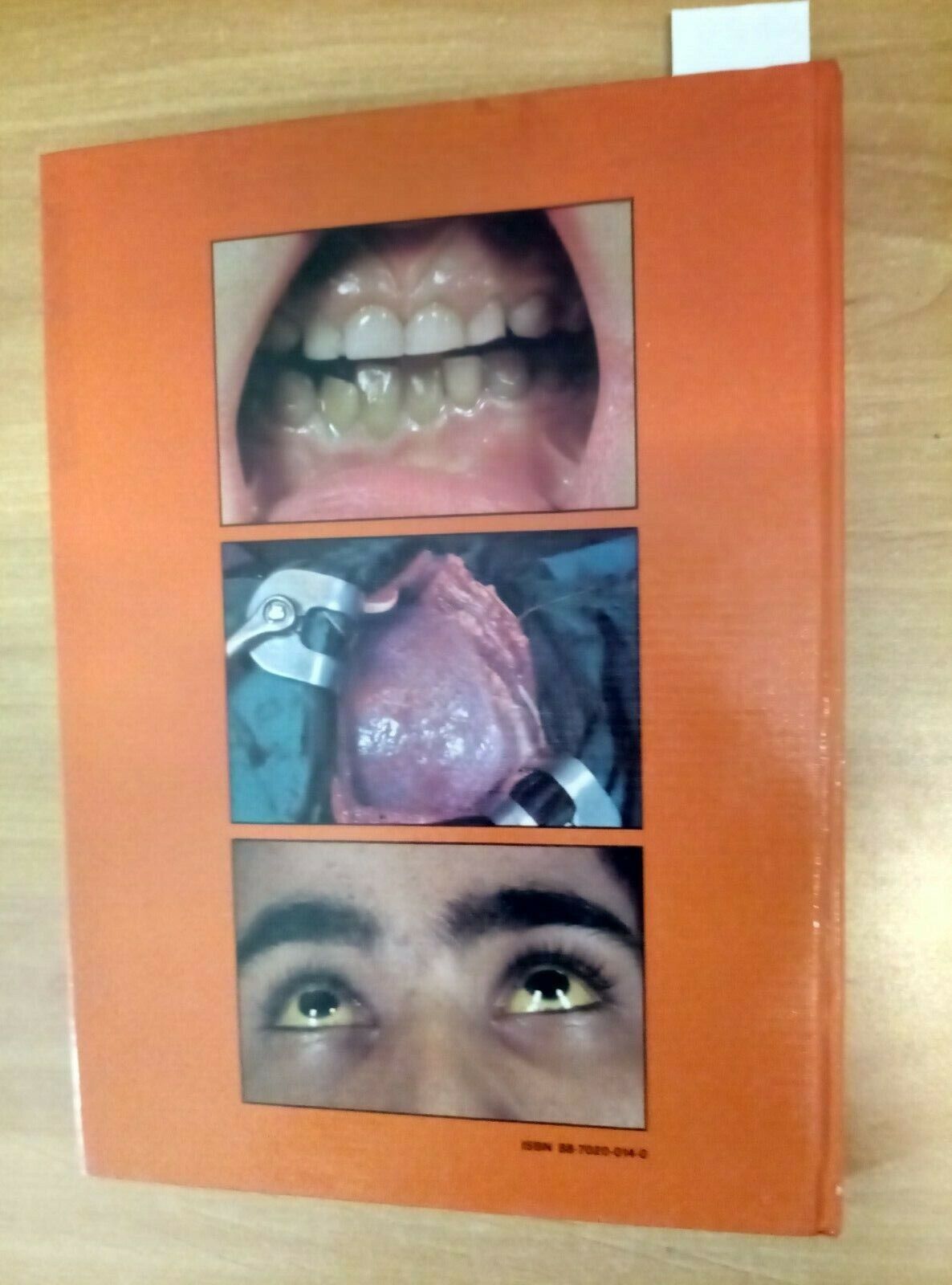 Ilsognalibro