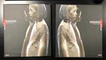 Aron Demetz. Electa 2004. Con cofanetto. Con dedica dell'artista