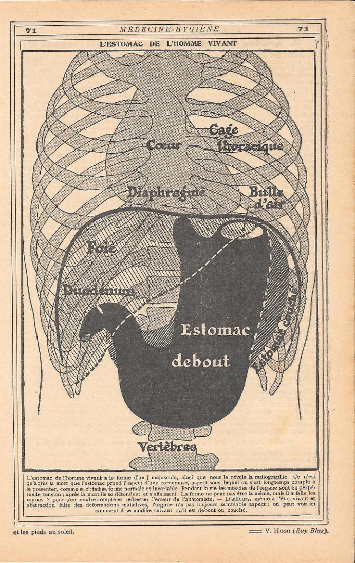 L' estomac de l'homme vivant. Stampa 1923