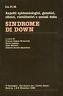 Sindrome di Down