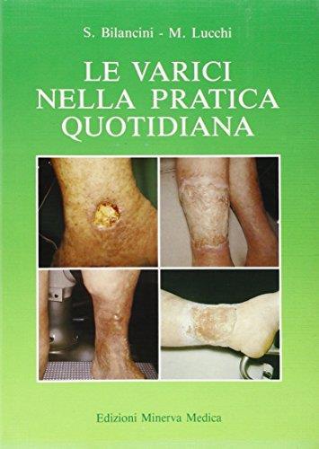 Le varici nella pratica quotidiana Bilancini, Salviano and Lucchi, Mari - copertina