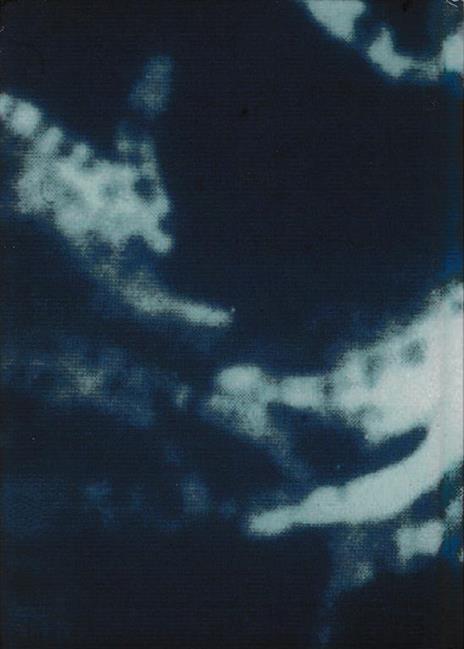 Micobatteriosi - Giandomenico Di Pisa - 2