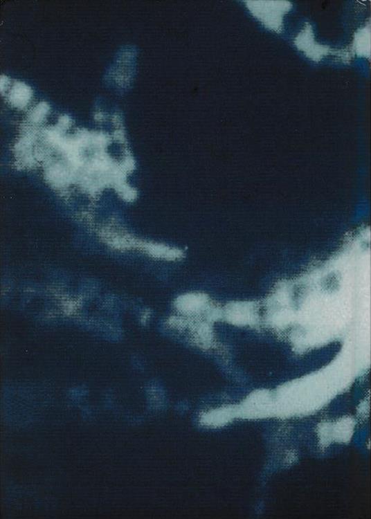 Micobatteriosi - Giandomenico Di Pisa - 2