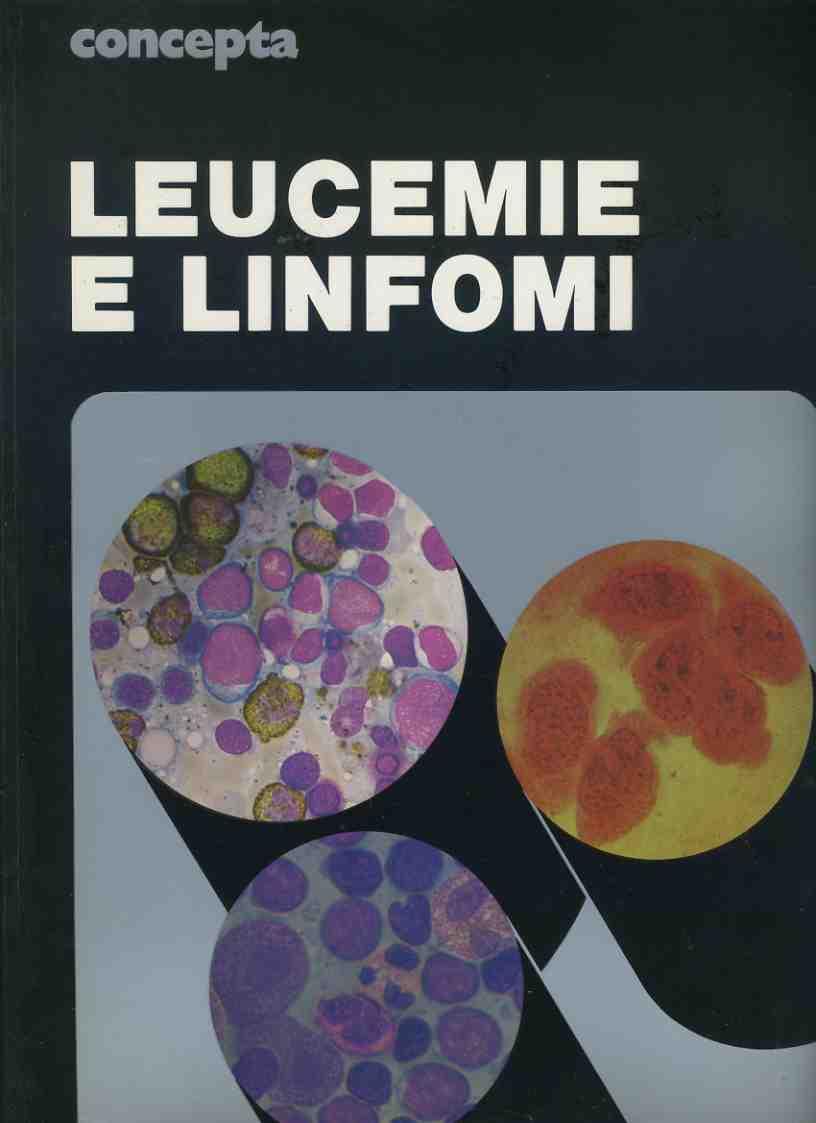 Leucemie e linfomi