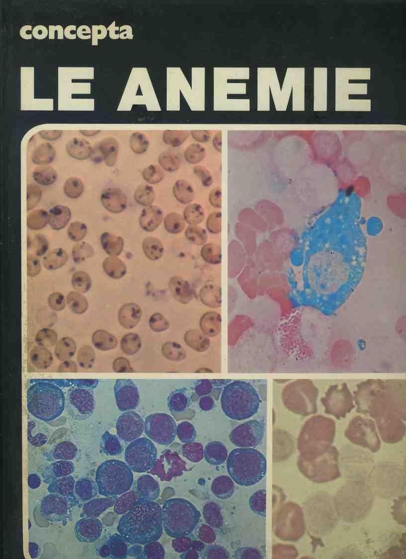 Le anemie