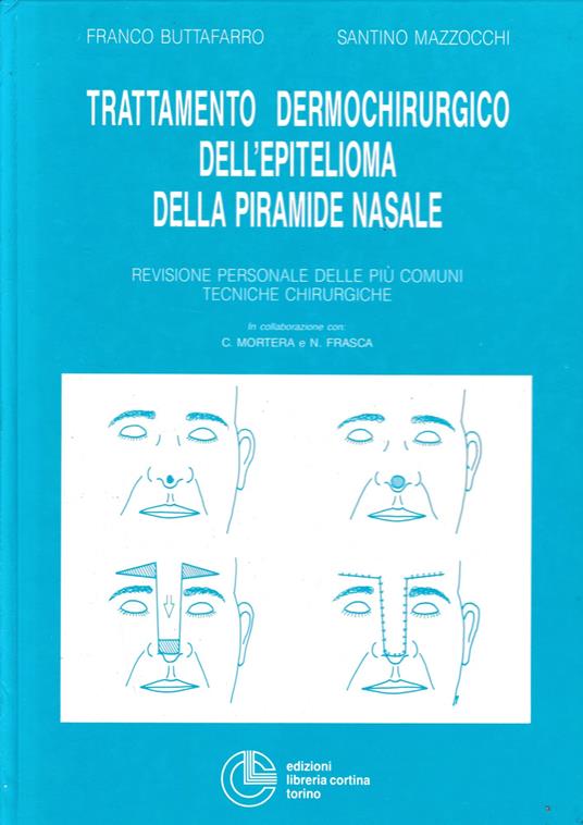 Trattamento dermochirurgico dell'epitelioma della piramide nasale - copertina