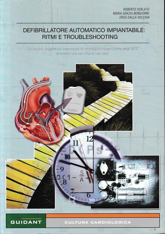 Defibrillatore automatico impiantabile: Ritmi e Troubleshooting - copertina