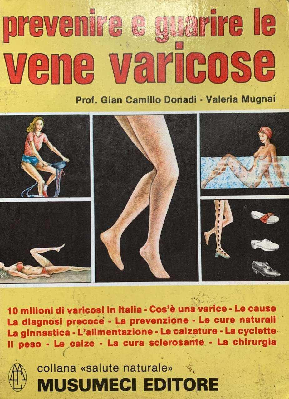 Prevenire e guarire le vene varicose