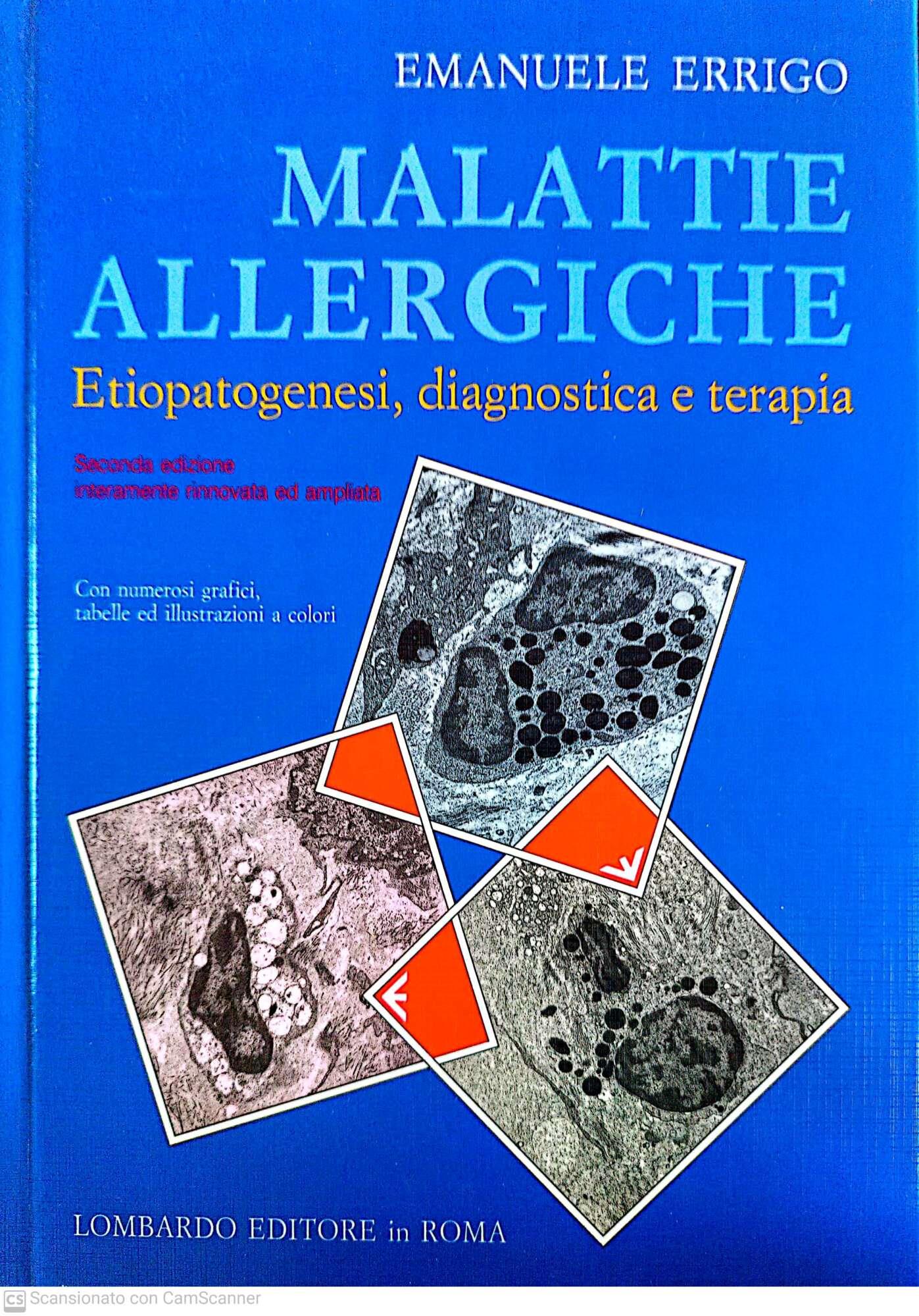 Malattie allergiche