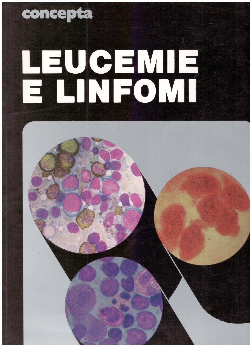 Concepta. Leucemie e linfomi