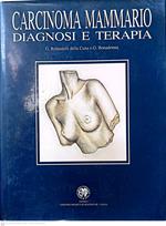 Carcinoma mammario diagnosi e terapia