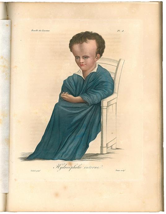 Nosologie naturelle ou les maladies du corps humain distribuées par familles [...] avec 33 planches coloriees. 1817 - Jean-Louis-Marie Alibert - copertina