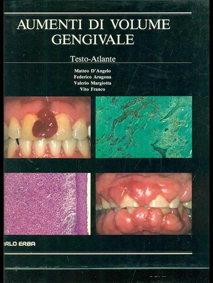 Aumenti di volume gengivale - copertina